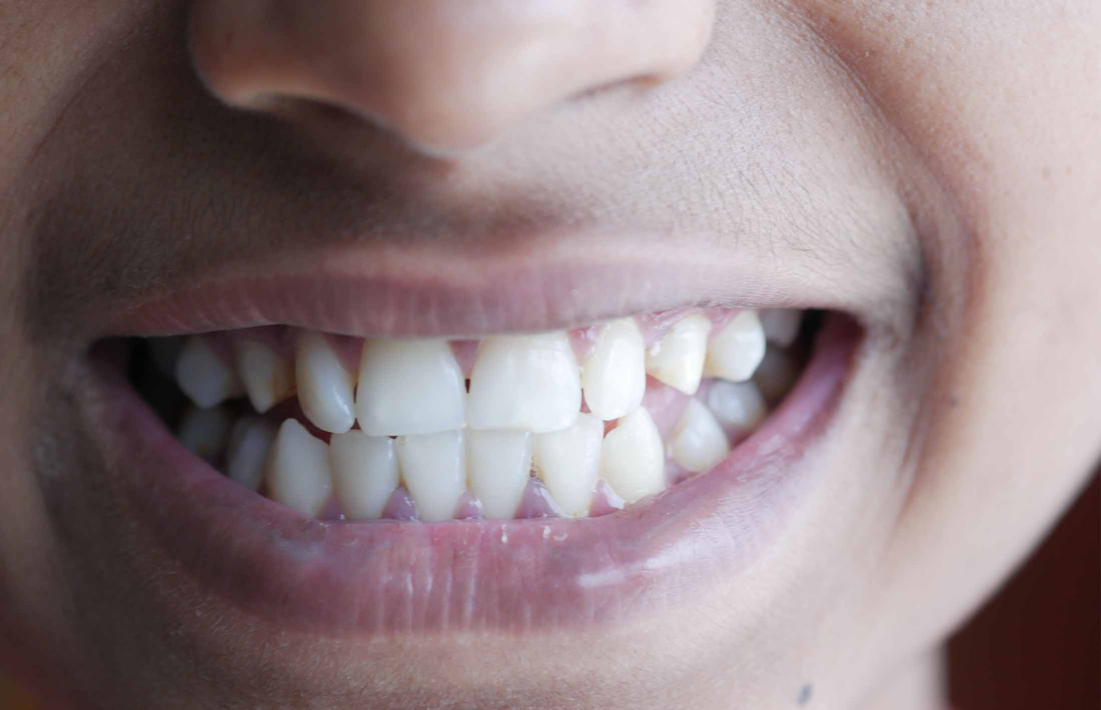 Witbank_Dentist_Practice_Witbank-Gum-2